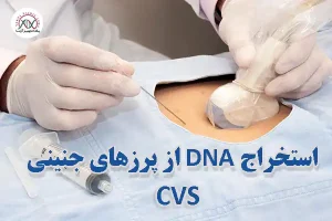 CVS